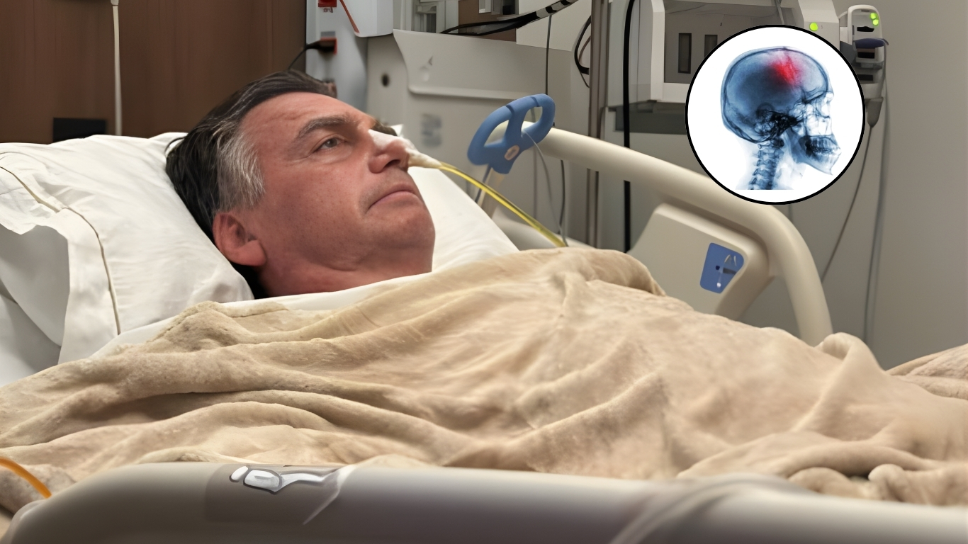 Jair Bolsonaro sofre traumatismo craniano após queda na cela.